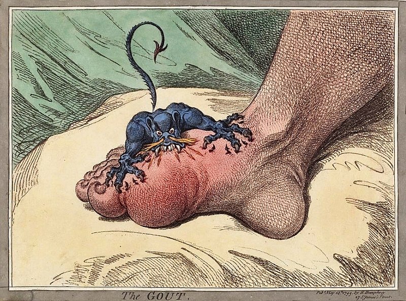 800px-The_gout_james_gillray.jpg