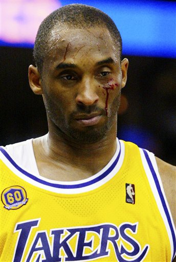 kobe-bleeding-warriors.jpg