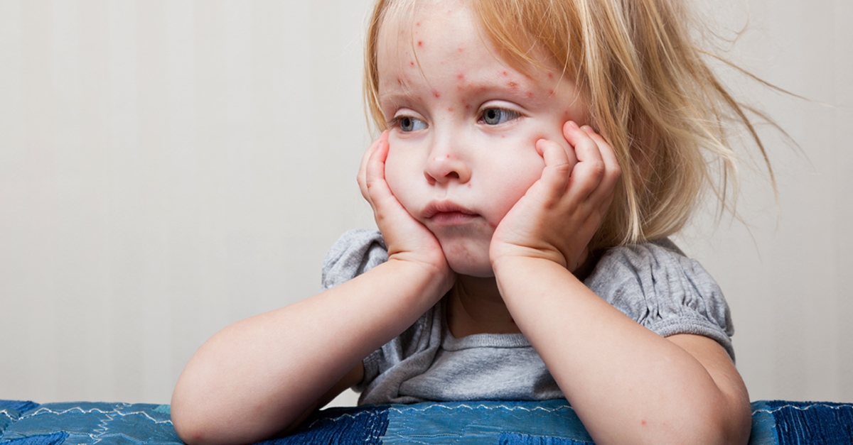 Anti-Vaxxer-Parents-Are-Now-Bringing-Their-Kids-to-Chicken-Pox-Parties-to-Infect-Them.jpg