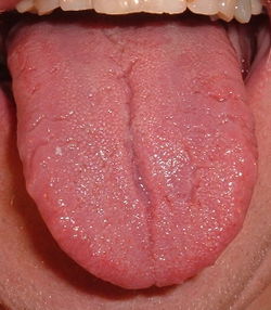 tongue1.jpg