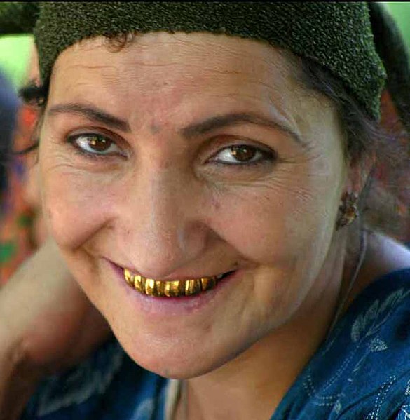 585px-Tajikistan_gold_teeth.jpg