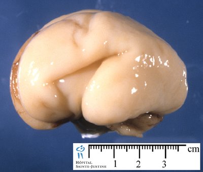 fetal_brain_22weeks.jpg