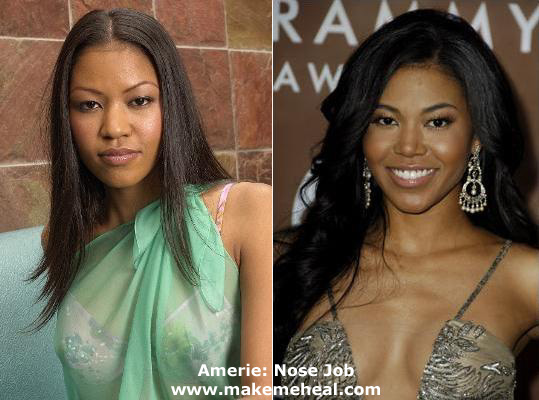 amerie-nose-job.jpg