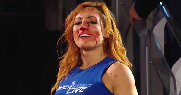 becky-lynch-15.jpg