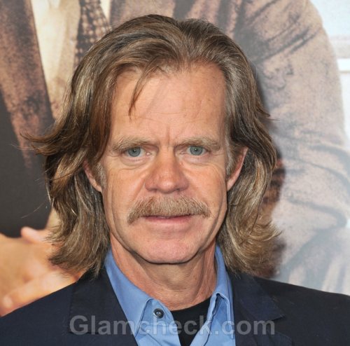William-H-Macy-in-Recovery-After-Removal-of-Cancer-Spot.jpg